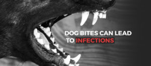 Dog Bites can Lead to Infections