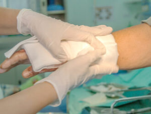 Philadelphia Burn Injury Lawyer