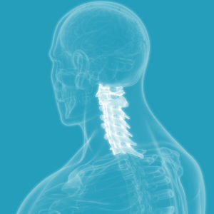 Cost of Spinal Cord Injury