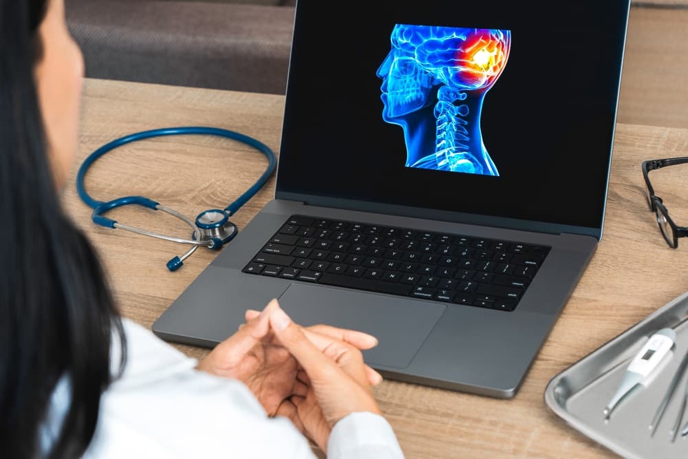 Doctor displays a laptop x-ray revealing brain pain, discussing a migraine headache.